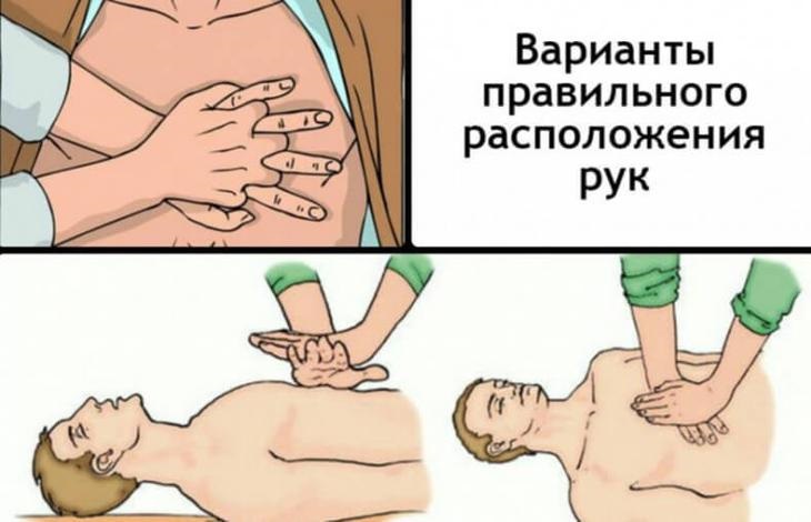 Искусственное дыхание